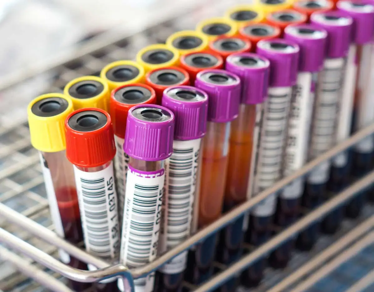 Can Police Make You Give a Blood Sample for a DUI?