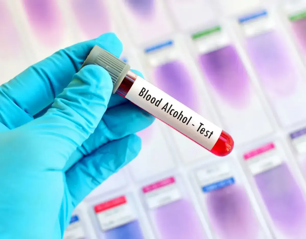 A gloved hand holds a blood sample vial labeled Blood Alcohol - Test.