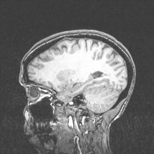 atlanta-brain-injury-lawyer.jpg