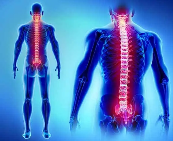 Spine Injury